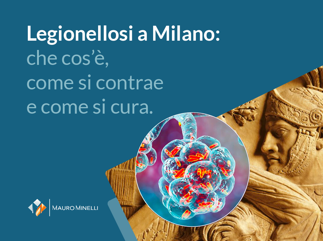 Focolaio di Legionellosi a Milano: guida all’infezione
