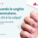 Quando si ammalano le unghie: di chi è la colpa?