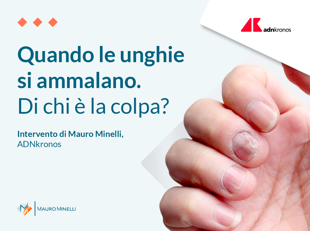 Quando si ammalano le unghie: di chi è la colpa?